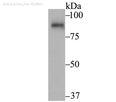 HUABIO ET7108-91 image 3