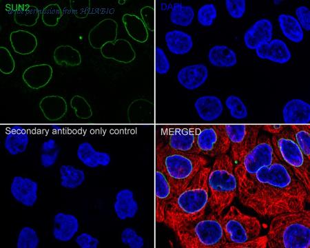 HUABIO ET7108-92 image 2