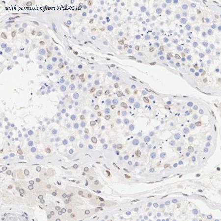 HUABIO ET7108-92 image 3