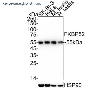 HUABIO ET7108-93 image 1