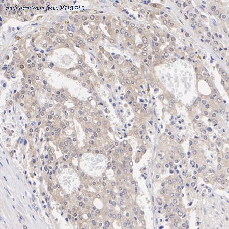 HUABIO ET7108-93 image 2