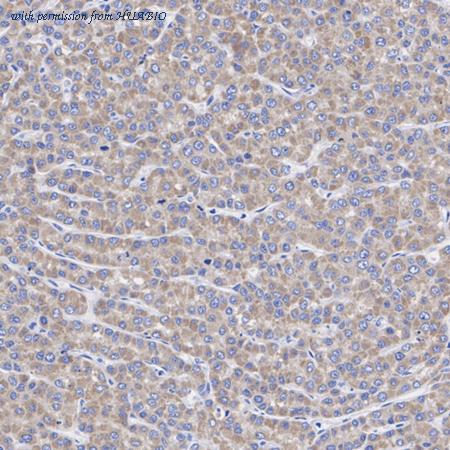 HUABIO ET7109-05 image 3