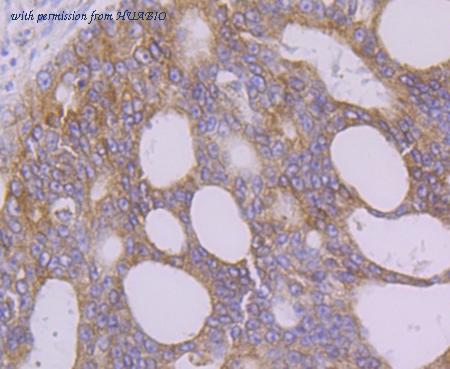 HUABIO ET7109-06 image 2