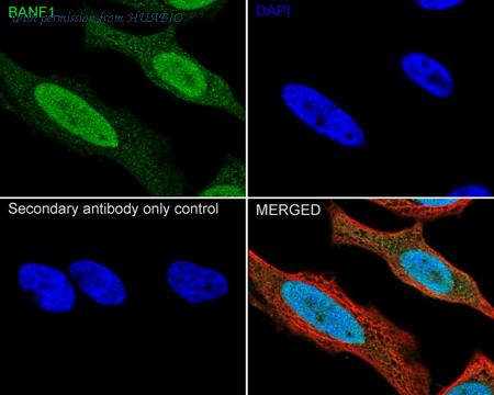 HUABIO ET7109-08 image 2