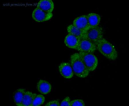 HUABIO ET7109-11 image 2