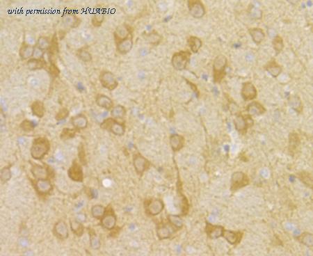 HUABIO ET7109-13 image 2