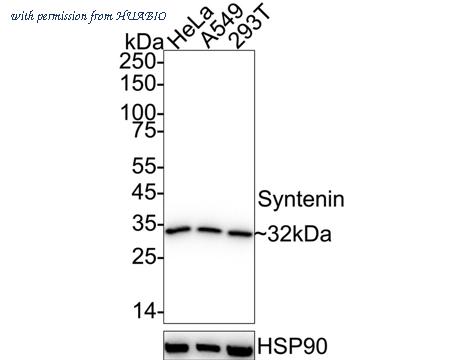 HUABIO ET7109-14 image 1