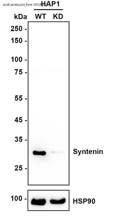 HUABIO ET7109-14 image 2