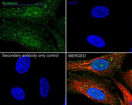 HUABIO ET7109-14 image 3
