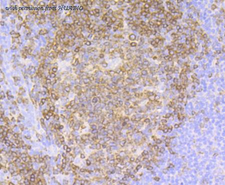 HUABIO ET7109-33 image 2