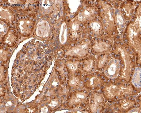 HUABIO ET7109-34 image 3