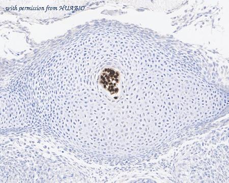 HUABIO ET7109-35 image 2