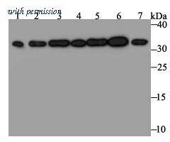 HUABIO ET7109-41 image 1