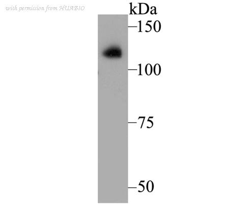 HUABIO ET7109-43 image 1