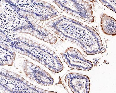 HUABIO ET7109-45 image 3