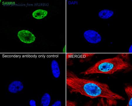 HUABIO ET7109-52 image 2