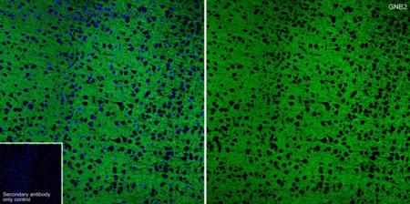 HUABIO ET7109-53 image 2