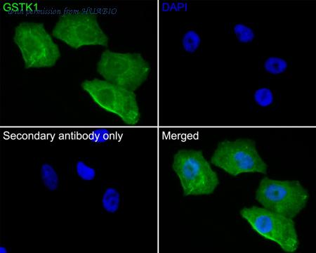 HUABIO ET7109-58 image 3