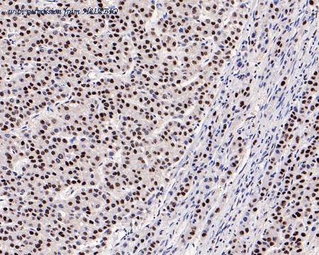 HUABIO ET7109-59 image 3