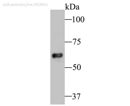 HUABIO ET7109-79 image 1