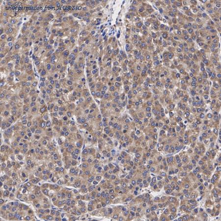 HUABIO ET7109-79 image 3