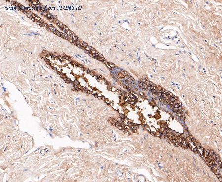 HUABIO ET7109-80 image 3