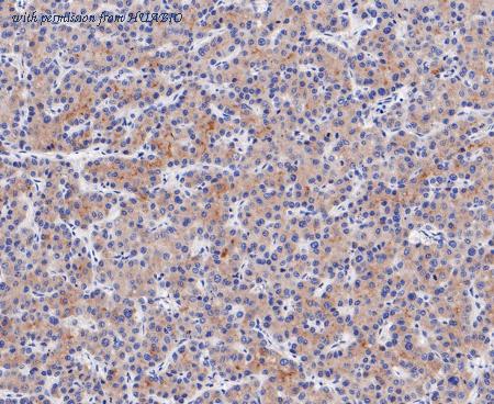 HUABIO ET7109-86 image 3