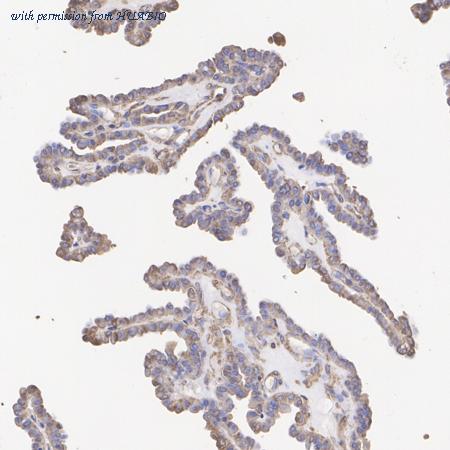 HUABIO ET7110-03 image 2