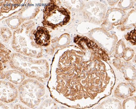 HUABIO ET7110-04 image 3