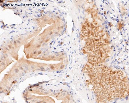 HUABIO ET7110-07 image 2