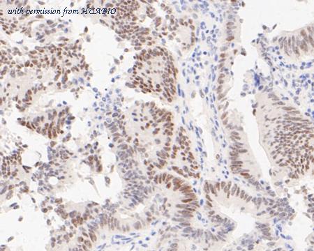 HUABIO ET7110-08 image 2