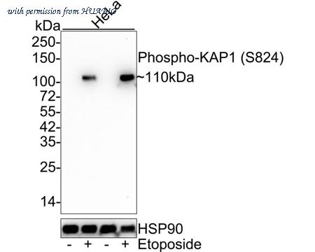 HUABIO ET7110-11 image 1