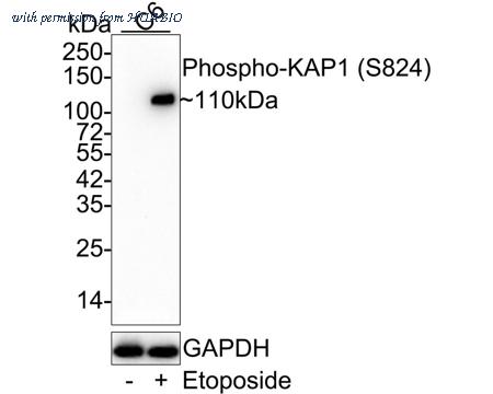 HUABIO ET7110-11 image 2