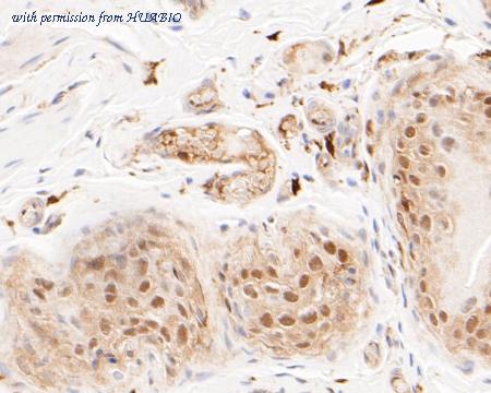 HUABIO ET7110-13 image 2