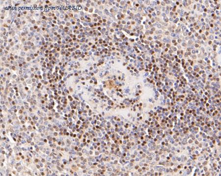 HUABIO ET7110-13 image 3