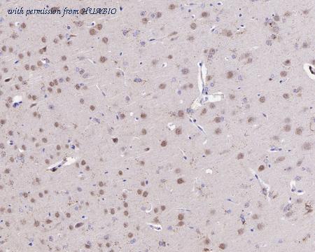 HUABIO ET7110-17 image 1