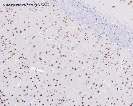 HUABIO ET7110-17 image 2