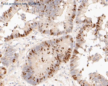 HUABIO ET7110-23 image 3