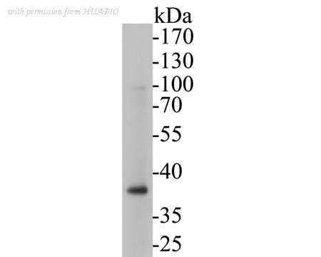 HUABIO ET7110-27 image 1