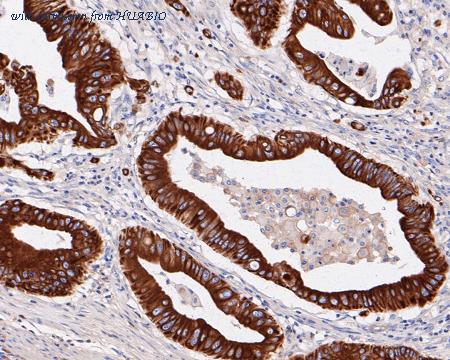 HUABIO ET7110-35 image 2