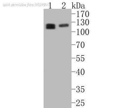 HUABIO ET7110-36 image 1
