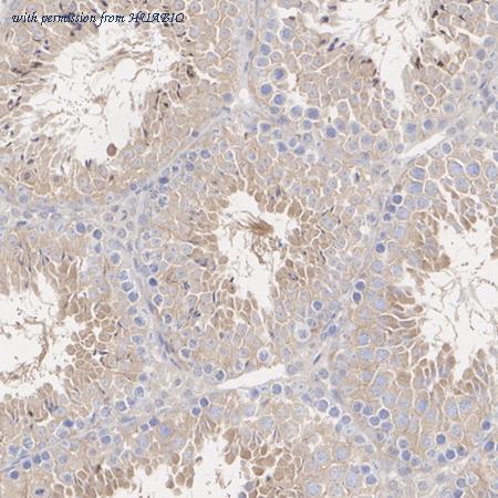 HUABIO ET7110-37 image 3