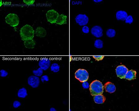 HUABIO ET7110-42 image 2