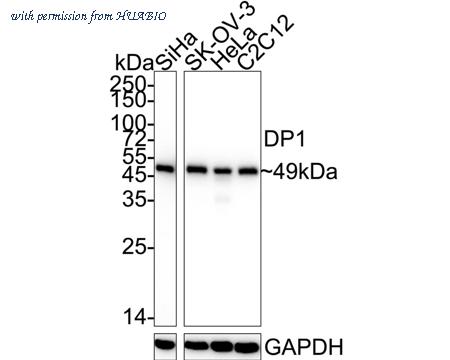 HUABIO ET7110-43 image 1