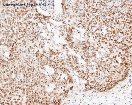 HUABIO ET7110-43 image 3