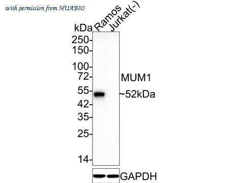 HUABIO ET7110-44 image 1