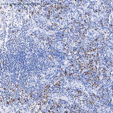 HUABIO ET7110-44 image 2