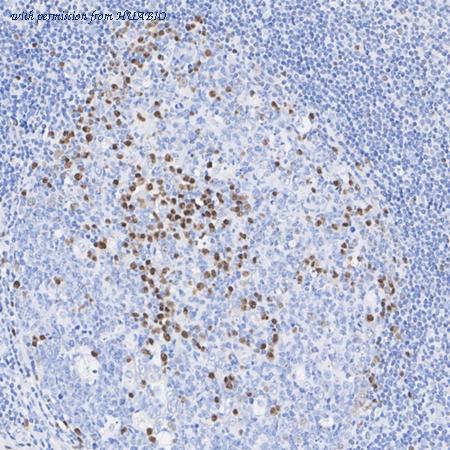 HUABIO ET7110-44 image 3