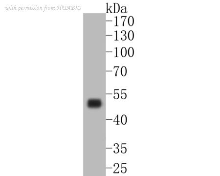 HUABIO ET7110-56 image 1