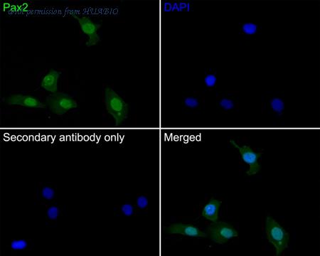HUABIO ET7110-57-50UL image 2